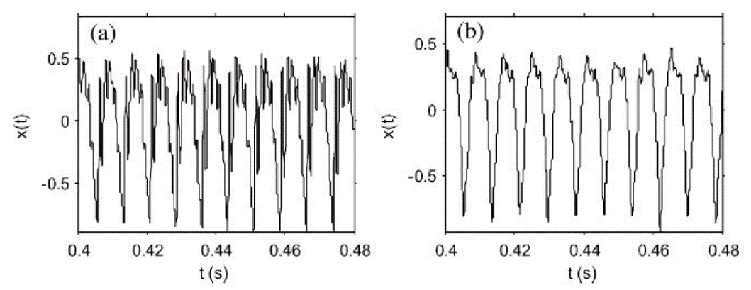 Examples of voice signals from [7]. This are two
examples of speech signal, (a) corresponds to a healthy person, (b) corresponds
to a person with PD. Also, X axis represents time in seconds, and Y axis is the
signal amplitude.