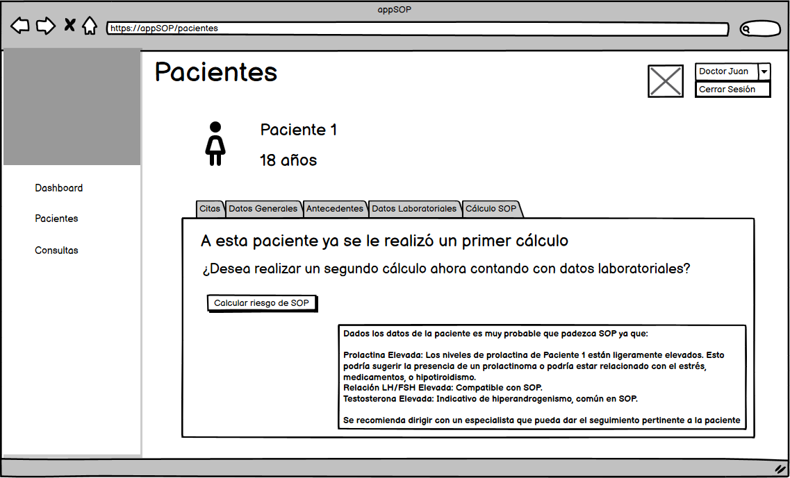 Pantalla cálculo de SOP en la aplicación web.